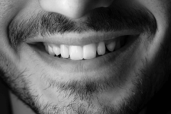 Man with orthodontic treatment smiling at Wolverhampton dentist with great results